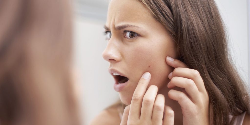 brufoli-sulla-fronte