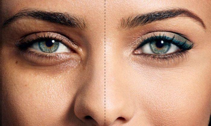 rimedi-borse-e-occhiaie | Charme Parfumerie de Luxe Molfetta rimedi-borse-e-occhiaie