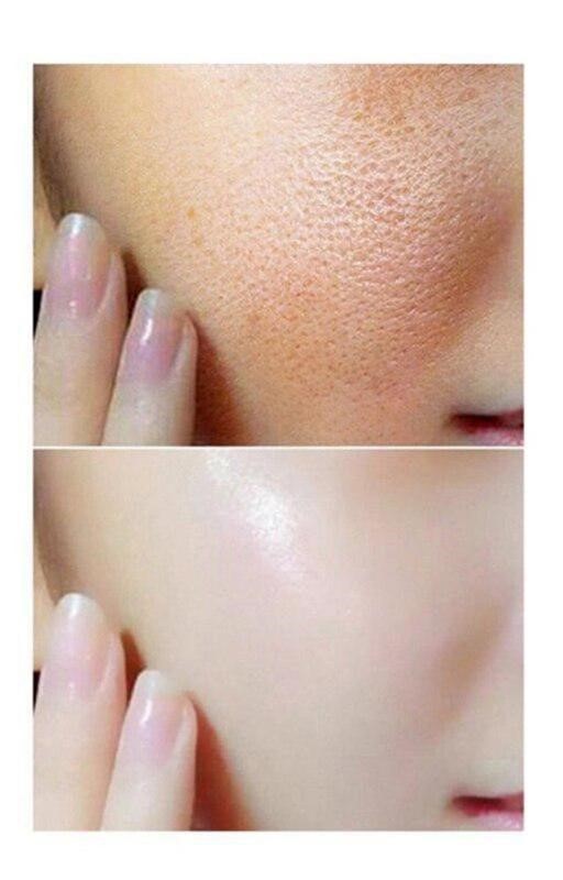 niacinamide-benefici